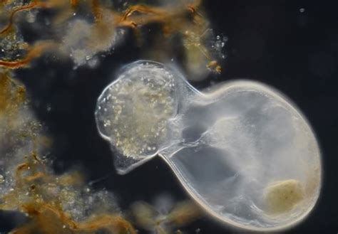  蓋倫氏纖毛蟲：一個有著神奇自我修復能力的微小生物！