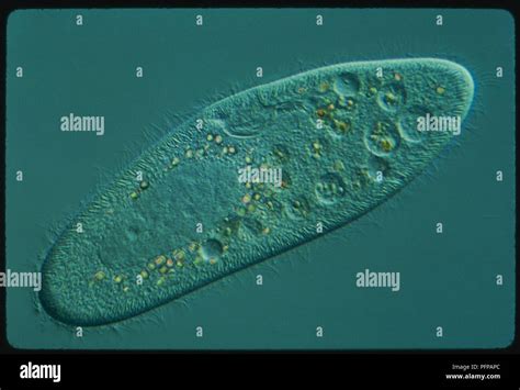  Paramecium！ 一個擁有閃爍光輝的微小宇宙的單細胞生物！